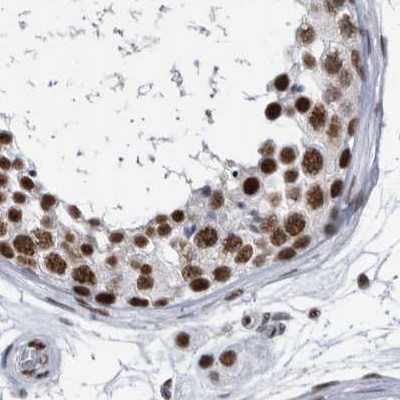 SF3A1 Antibody in Immunohistochemistry (IHC)