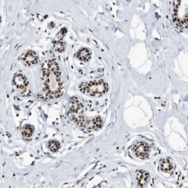 SF3A1 Antibody in Immunohistochemistry (IHC)