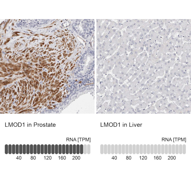 LMOD1 Antibody in Immunohistochemistry (IHC)