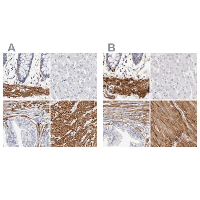 LMOD1 Antibody in Immunohistochemistry (IHC)