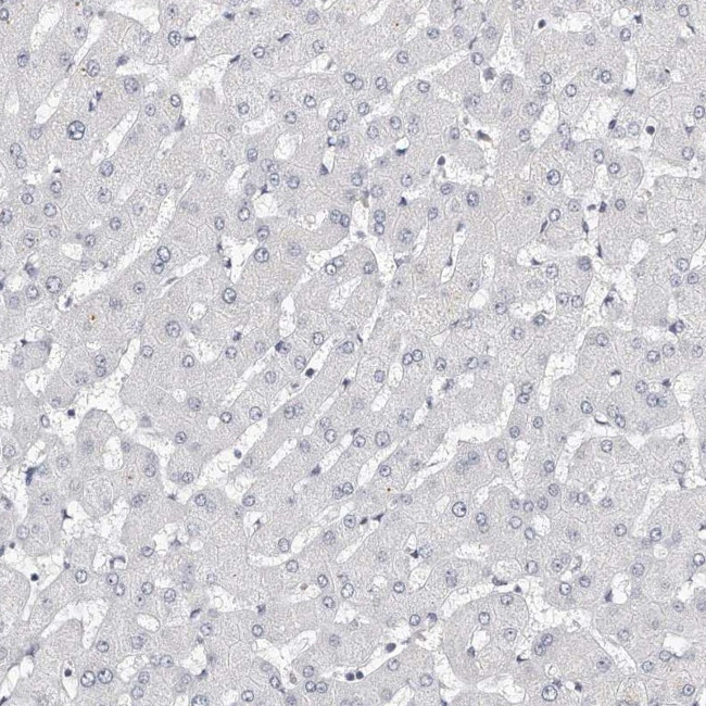 LMOD1 Antibody in Immunohistochemistry (IHC)