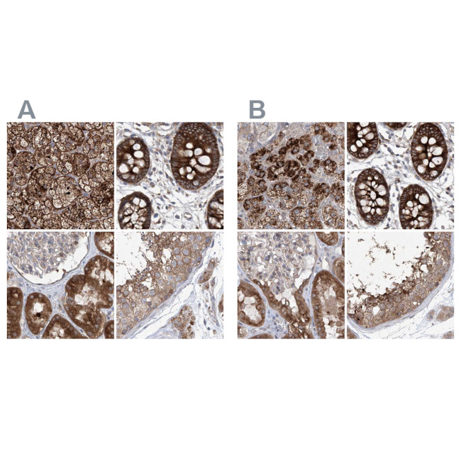 KLC4 Antibody in Immunohistochemistry (IHC)