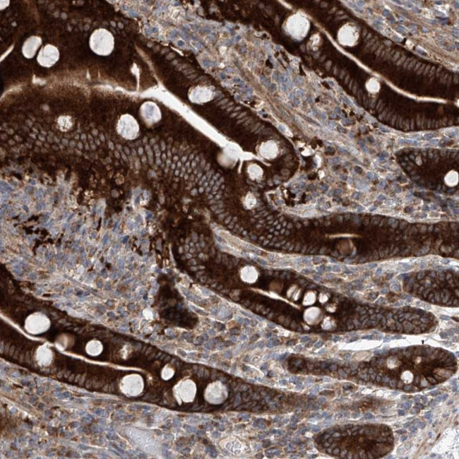 KLC4 Antibody in Immunohistochemistry (IHC)