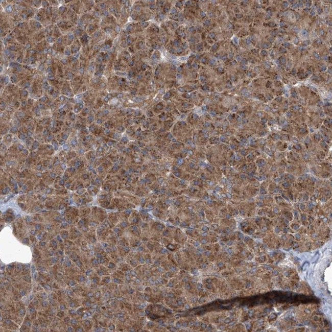 KLC4 Antibody in Immunohistochemistry (IHC)