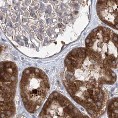 KLC4 Antibody in Immunohistochemistry (IHC)