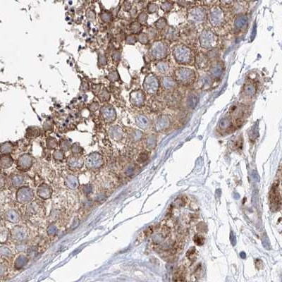 KLC4 Antibody in Immunohistochemistry (IHC)