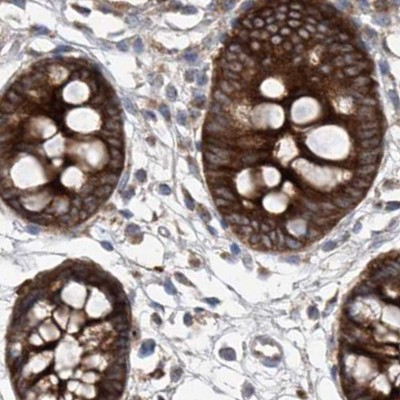 KLC4 Antibody in Immunohistochemistry (IHC)