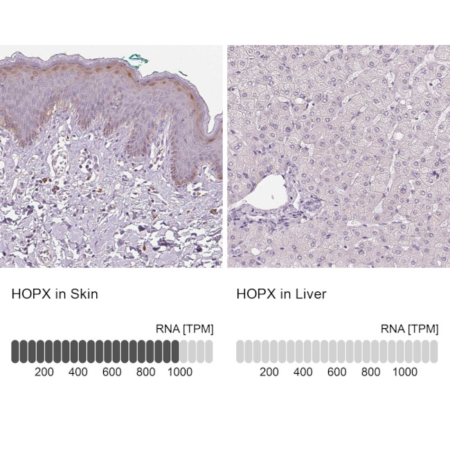 Hopx Antibody in Immunohistochemistry (IHC)