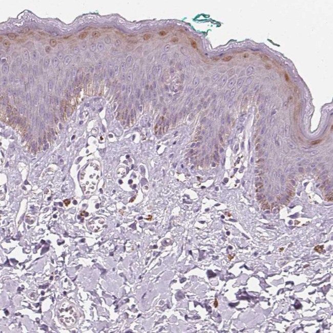 Hopx Antibody in Immunohistochemistry (IHC)