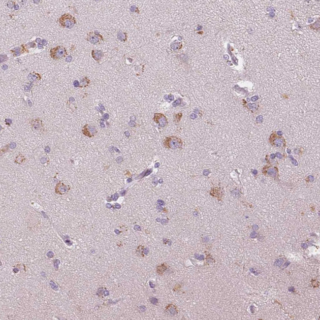 Hopx Antibody in Immunohistochemistry (IHC)