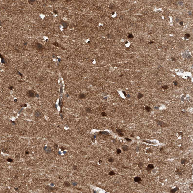 PDXK Antibody in Immunohistochemistry (IHC)