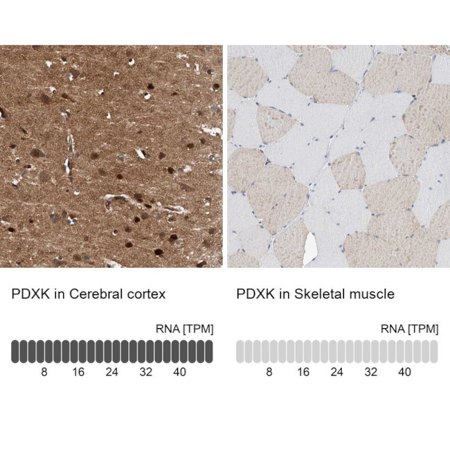 PDXK Antibody