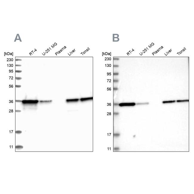 PDXK Antibody in Western Blot (WB)