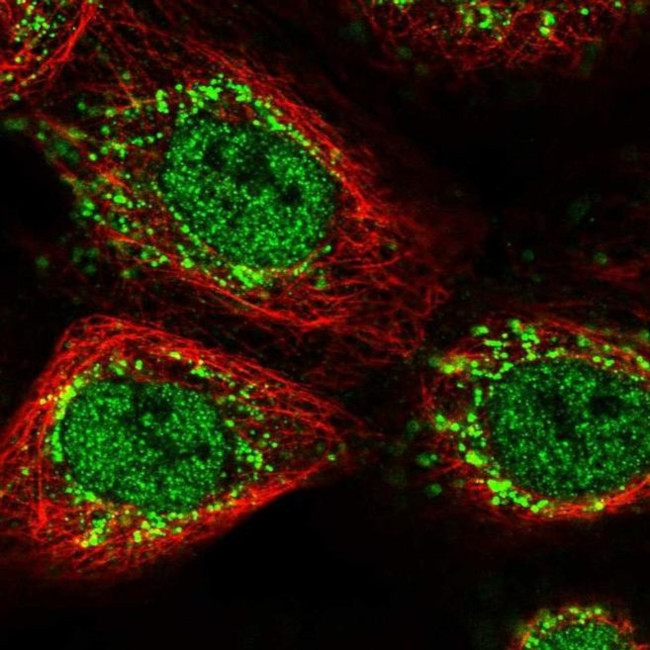 ZNF710 Antibody in Immunocytochemistry (ICC/IF)