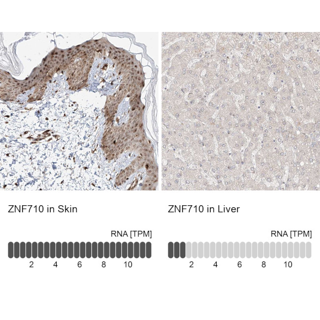 ZNF710 Antibody in Immunohistochemistry (IHC)