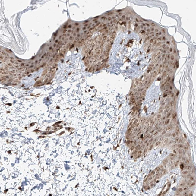 ZNF710 Antibody in Immunohistochemistry (IHC)