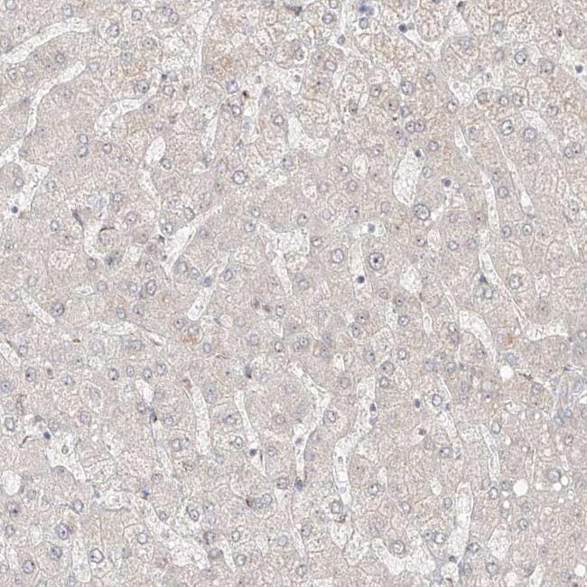 ZNF710 Antibody in Immunohistochemistry (IHC)