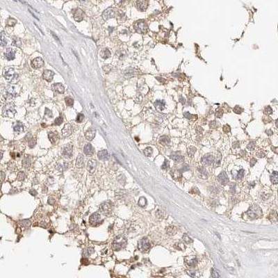 KCMF1 Antibody in Immunohistochemistry (IHC)