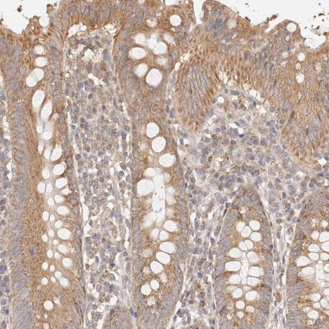 KCMF1 Antibody in Immunohistochemistry (IHC)