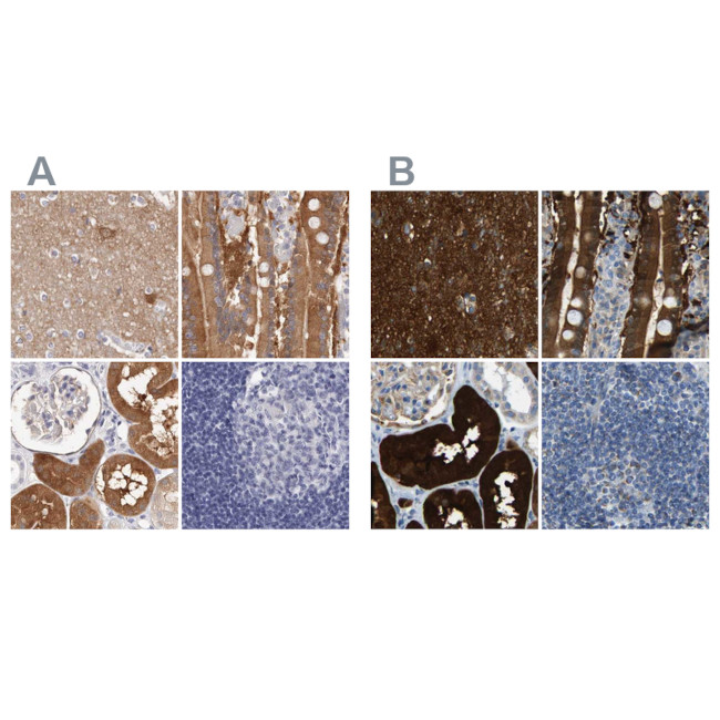 GDA Antibody in Immunohistochemistry (IHC)