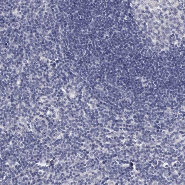 GDA Antibody in Immunohistochemistry (IHC)