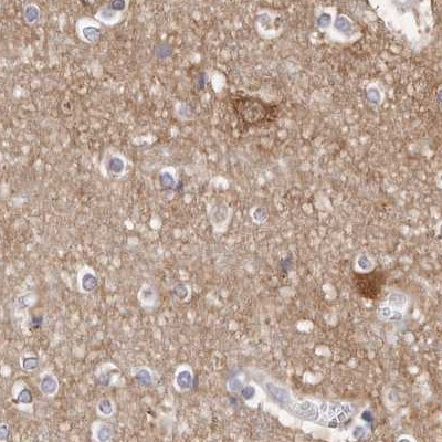 GDA Antibody in Immunohistochemistry (IHC)