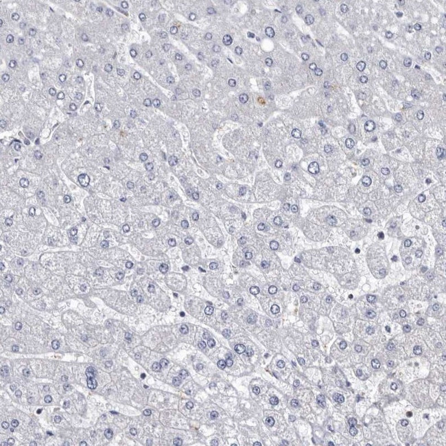 ABCF2 Antibody in Immunohistochemistry (IHC)