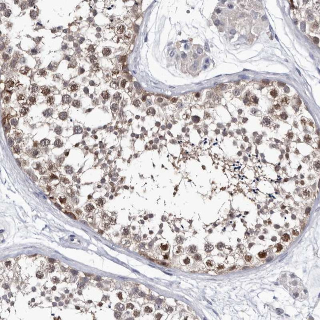 ABCF2 Antibody in Immunohistochemistry (IHC)