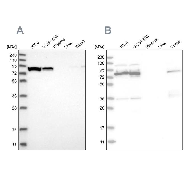 ABCF2 Antibody in Western Blot (WB)