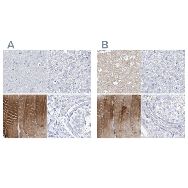 TXLNB Antibody in Immunohistochemistry (IHC)