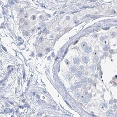 TXLNB Antibody in Immunohistochemistry (IHC)