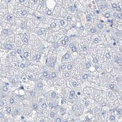 TXLNB Antibody in Immunohistochemistry (IHC)