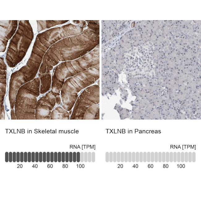 TXLNB Antibody in Immunohistochemistry (IHC)