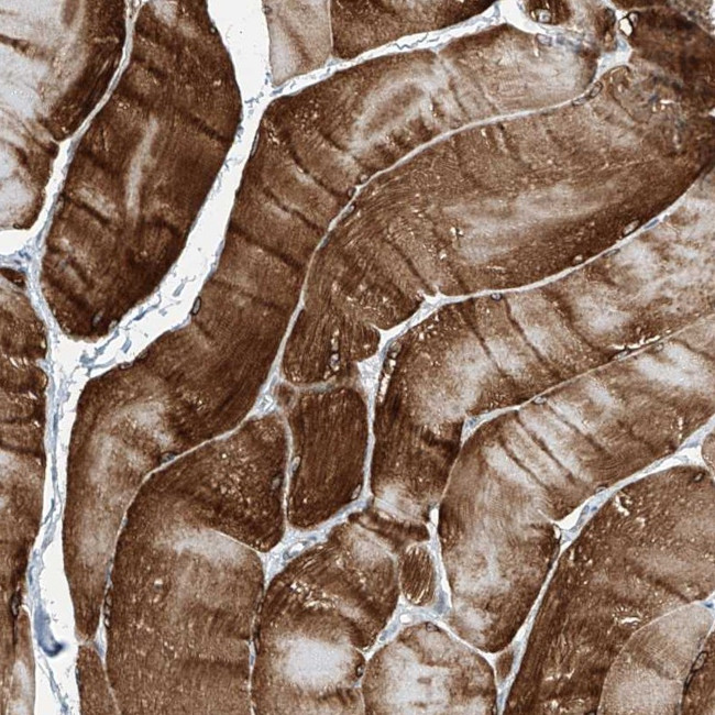 TXLNB Antibody in Immunohistochemistry (IHC)