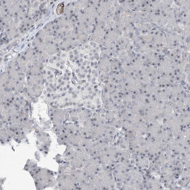 TXLNB Antibody in Immunohistochemistry (IHC)