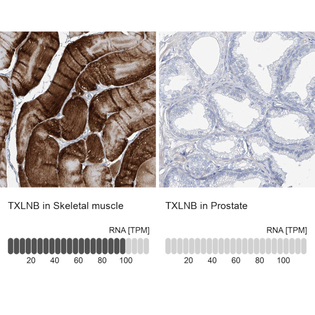 TXLNB Antibody in Immunohistochemistry (IHC)