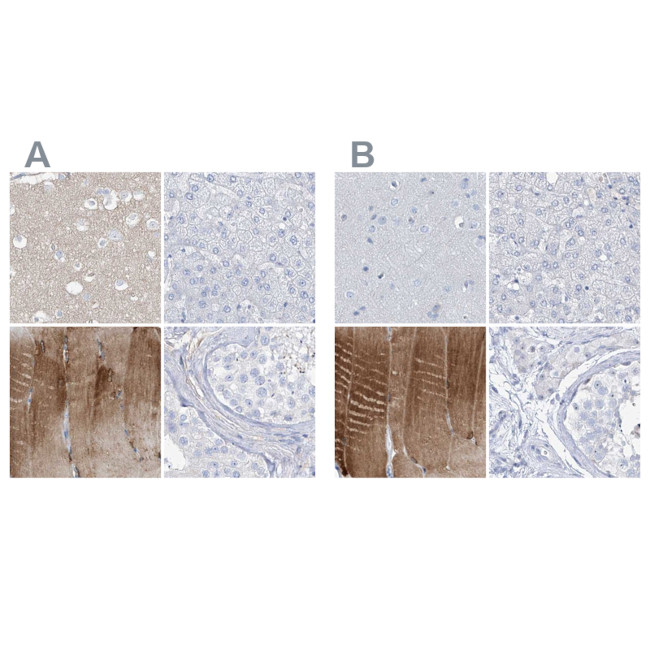 TXLNB Antibody in Immunohistochemistry (IHC)