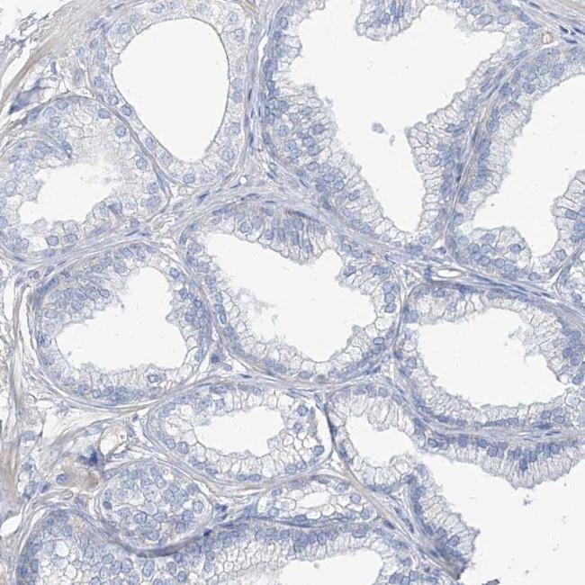 TXLNB Antibody in Immunohistochemistry (IHC)