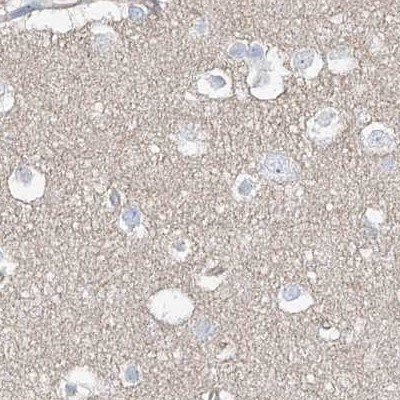 TXLNB Antibody in Immunohistochemistry (IHC)