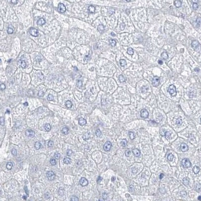 TXLNB Antibody in Immunohistochemistry (IHC)