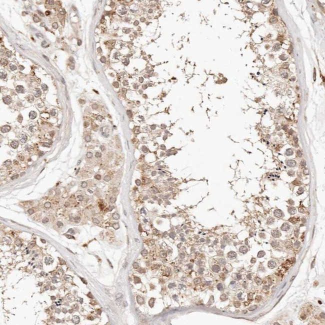 KIF9 Antibody in Immunohistochemistry (IHC)