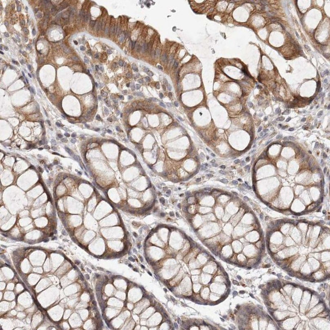 MICAL2 Antibody in Immunohistochemistry (IHC)