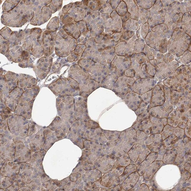 MICAL2 Antibody in Immunohistochemistry (IHC)