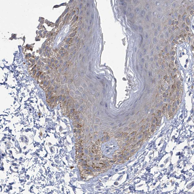 PARD3 Antibody in Immunohistochemistry (IHC)