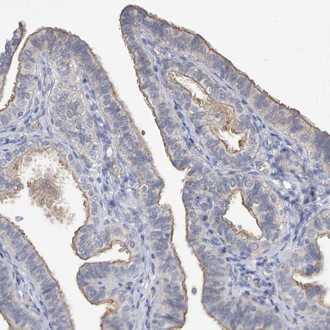 PARD3 Antibody in Immunohistochemistry (IHC)