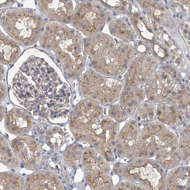 PARD3 Antibody in Immunohistochemistry (IHC)