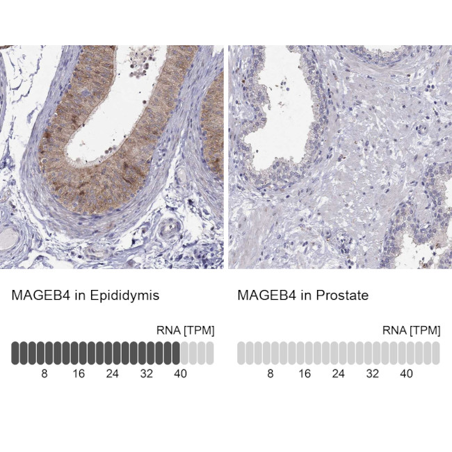 MAGEB4 Antibody in Immunohistochemistry (IHC)