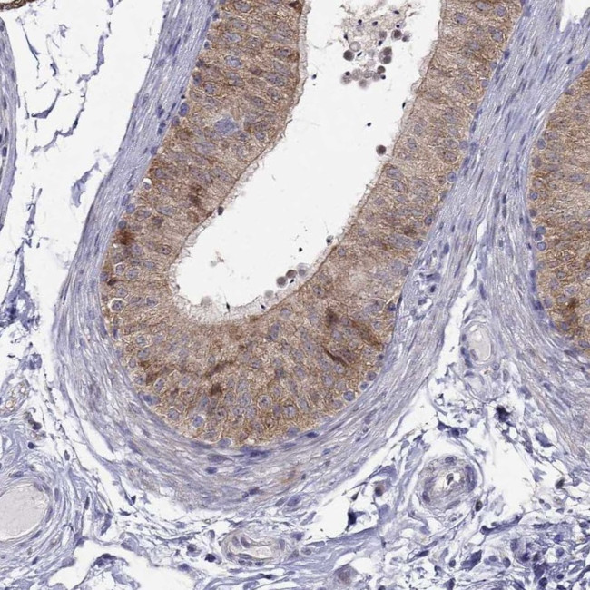 MAGEB4 Antibody in Immunohistochemistry (IHC)