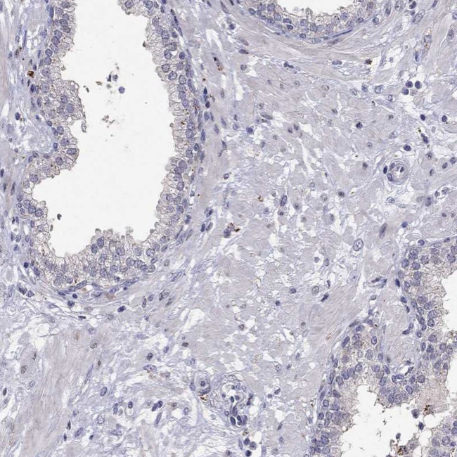 MAGEB4 Antibody in Immunohistochemistry (IHC)