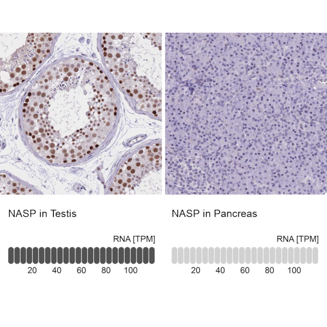 NASP Antibody in Immunohistochemistry (IHC)